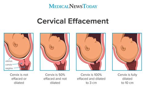 Can You Swim If Your Cervix Is Dilated? Exploring the Intersection of Anatomy and Aquatic Activities